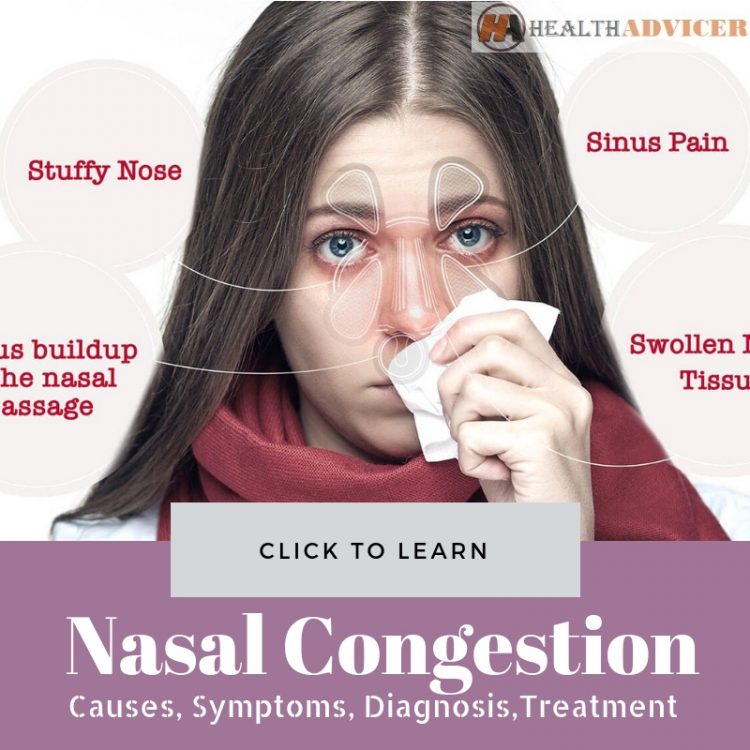 Pathophysiology of Nasal Congestion