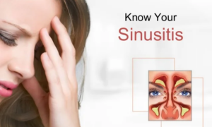 Are Bacterial Sinus Infections Contagious Through Kissing
