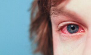 Can Contacts Cause Corneal Abrasion