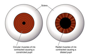 Do Pupils Dilate During a Stroke