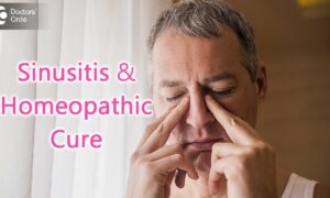 Homeopathic Remedies for Sinusitis UK