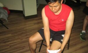 Knee Contusion Swelling