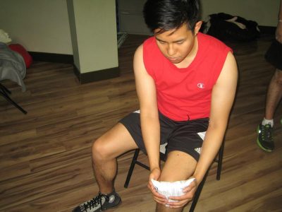 Knee Contusion Swelling