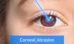 corneal abrasion still hurts months later