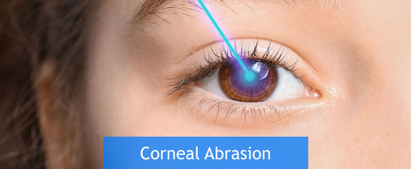 corneal abrasion still hurts months later